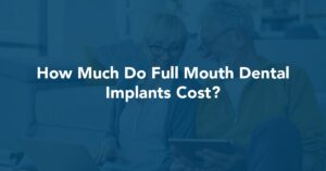 How Much Do Full Mouth Dental Implants Cost? at Prestige Oral Surgery